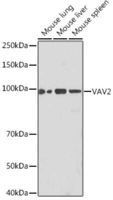 Western Blot: VAV2 Antibody (3S0O9) [NBP3-16218]