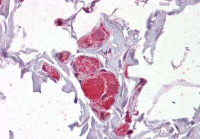 Immunohistochemistry-Paraffin: VAV2 Antibody [NB100-895]