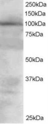 Western Blot: VAV2 Antibody [NB100-895]