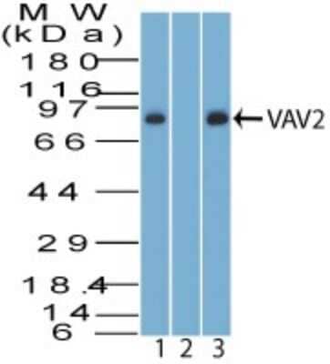 Western Blot: VAV2 Antibody [NBP2-27078]