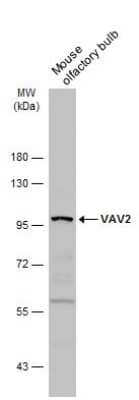 Western Blot: VAV2 Antibody [NBP3-13026]