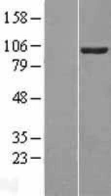 Western Blot: VAV2 Overexpression Lysate [NBL1-17702]