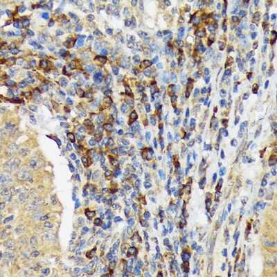 Immunohistochemistry-Paraffin: VAV3 Antibody (9A10D8) [NBP3-16615]