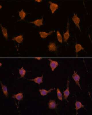 Immunocytochemistry/ Immunofluorescence: VAV3 Antibody - Azide and BSA Free [NBP2-93949]
