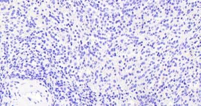Immunohistochemistry-Paraffin: VAV3 Antibody [NB300-817]