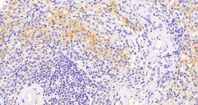 Immunohistochemistry-Paraffin: VAV3 Antibody [NB300-817]