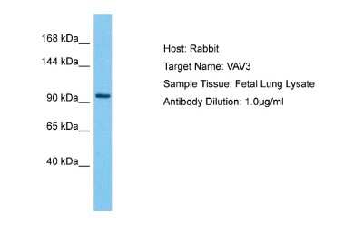 Western Blot: VAV3 Antibody [NBP2-86891]