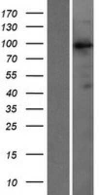 Western Blot: VAV3 Overexpression Lysate [NBP2-07663]