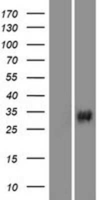 Western Blot: VAV3 Overexpression Lysate [NBP2-08481]