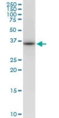 Western Blot: VAX1 Antibody (2F4) [H00011023-M03]