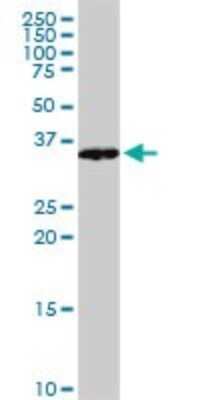 Western Blot: VAX1 Antibody (2F4) [H00011023-M03]