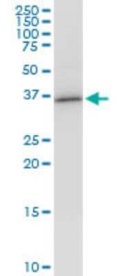 Western Blot: VAX1 Antibody (2F4) [H00011023-M03]