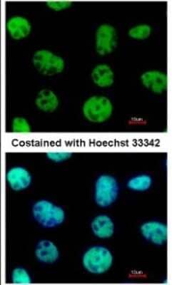 Immunocytochemistry/ Immunofluorescence: VAX2 Antibody [NBP2-15161]