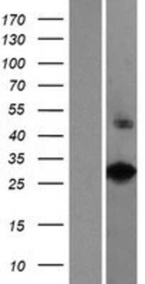 Western Blot: VAX2 Overexpression Lysate [NBP2-07436]