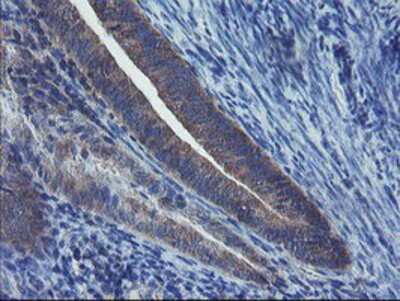 Immunohistochemistry-Paraffin: VBP1 Antibody (OTI2A3) [NBP2-03754]