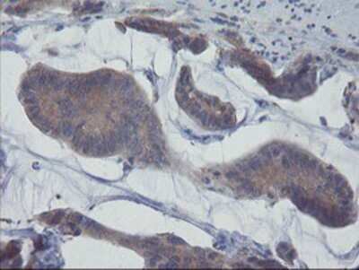 Immunohistochemistry-Paraffin: VBP1 Antibody (OTI2A3) [NBP2-03754]