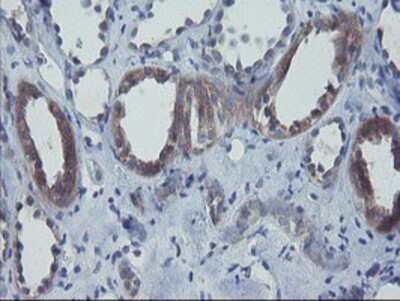 Immunohistochemistry-Paraffin: VBP1 Antibody (OTI2A3) [NBP2-03754]