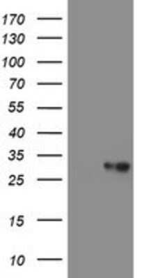 Western Blot: VBP1 Antibody (OTI2A3) [NBP2-03754]