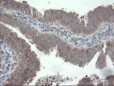 Immunohistochemistry: VBP1 Antibody (OTI2E6) [NBP2-46329]