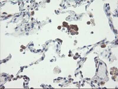 Immunohistochemistry: VBP1 Antibody (OTI2E6) [NBP2-46329]