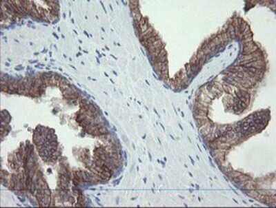 Immunohistochemistry: VBP1 Antibody (OTI2E6) [NBP2-46329]