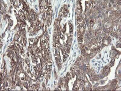 Immunohistochemistry: VBP1 Antibody (OTI2E6) [NBP2-46329]