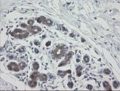 Immunohistochemistry: VBP1 Antibody (OTI2E6) [NBP2-46329]