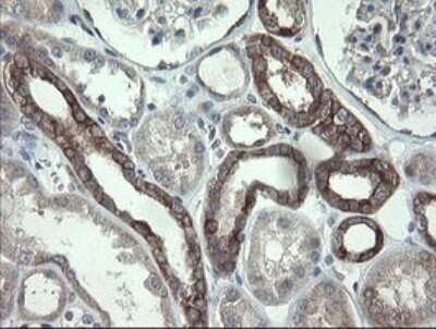 Immunohistochemistry: VBP1 Antibody (OTI2E6) [NBP2-46329]