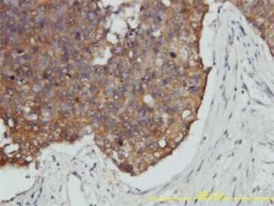 Immunohistochemistry-Paraffin: VBP1 Antibody (3D11) [H00007411-M01]