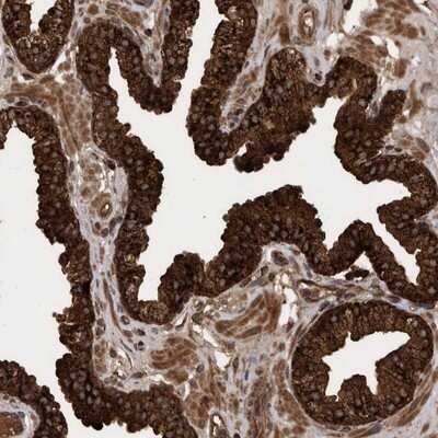 Immunohistochemistry-Paraffin: VBP1 Antibody [NBP1-80922]