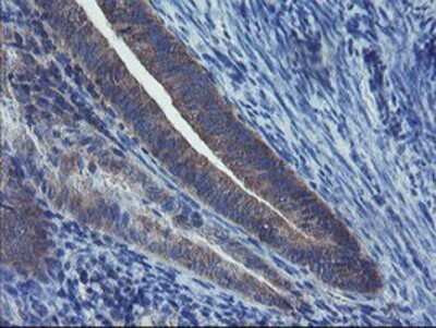 Immunohistochemistry: VBP1 Antibody (OTI2A3) - Azide and BSA Free [NBP2-74833]