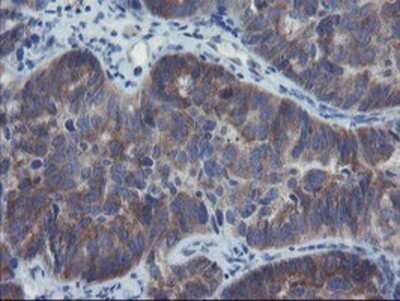 Immunohistochemistry: VBP1 Antibody (OTI2A3) - Azide and BSA Free [NBP2-74833]