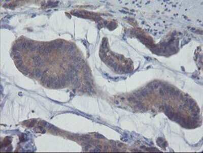 Immunohistochemistry: VBP1 Antibody (OTI2A3) - Azide and BSA Free [NBP2-74833]