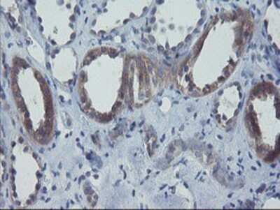 Immunohistochemistry: VBP1 Antibody (OTI2A3) - Azide and BSA Free [NBP2-74833]