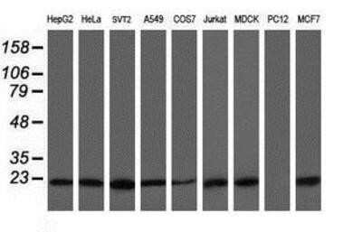 Western Blot: VBP1 Antibody (OTI2A3)Azide and BSA Free [NBP2-74833]