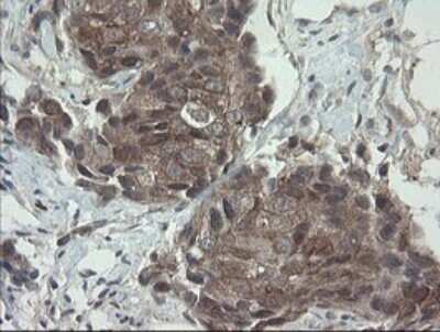 Immunohistochemistry: VBP1 Antibody (OTI2E6) - Azide and BSA Free [NBP2-74836]