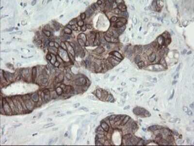 Immunohistochemistry: VBP1 Antibody (OTI2E6) - Azide and BSA Free [NBP2-74836]