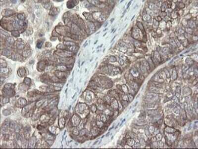 Immunohistochemistry: VBP1 Antibody (OTI2E6) - Azide and BSA Free [NBP2-74836]