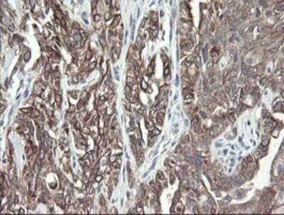 Immunohistochemistry: VBP1 Antibody (OTI2E6) - Azide and BSA Free [NBP2-74836]