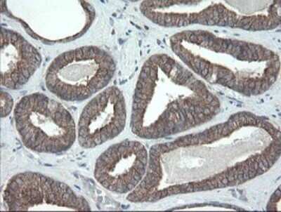Immunohistochemistry: VBP1 Antibody (OTI2E6) - Azide and BSA Free [NBP2-74836]