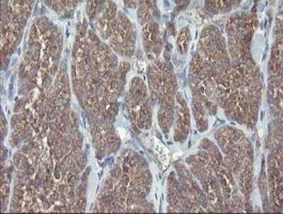 Immunohistochemistry: VBP1 Antibody (OTI2E6) - Azide and BSA Free [NBP2-74836]