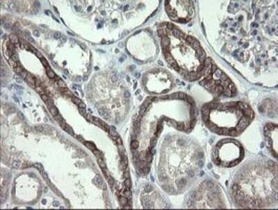 Immunohistochemistry: VBP1 Antibody (OTI2E6) - Azide and BSA Free [NBP2-74836]