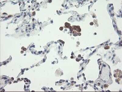 Immunohistochemistry: VBP1 Antibody (OTI2E6) - Azide and BSA Free [NBP2-74836]