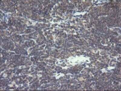 Immunohistochemistry: VBP1 Antibody (OTI2E6) - Azide and BSA Free [NBP2-74836]