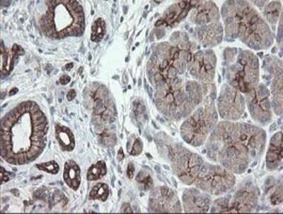 Immunohistochemistry: VBP1 Antibody (OTI2E6) - Azide and BSA Free [NBP2-74836]
