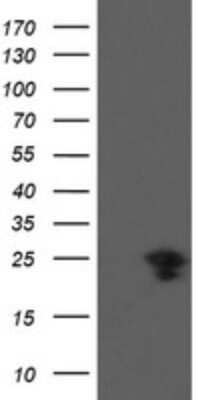 Western Blot: VBP1 Antibody (OTI2E6)Azide and BSA Free [NBP2-74836]