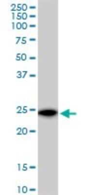 Western Blot: VBP1 Antibody [H00007411-B01P]