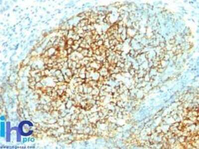 Immunohistochemistry-Paraffin: VCAM-1/CD106 Antibody (1.4C3) - Azide and BSA Free [NBP2-33182]