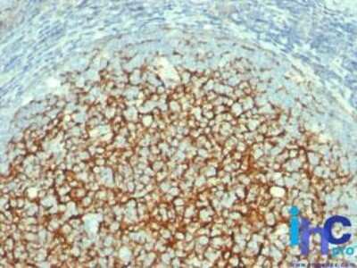 Immunohistochemistry-Paraffin: VCAM-1/CD106 Antibody (1.4C3) [NBP2-29413]