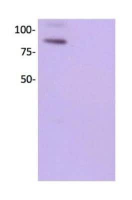 Western Blot: VCAM-1/CD106 Antibody (1.4C3) [NBP2-29413]